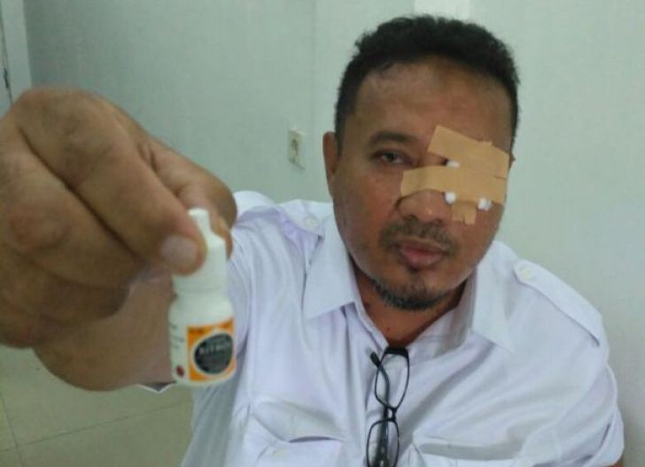 Photo of Pakai Obat Apotek, Warga Pontianak Barat  Nyaris Buta